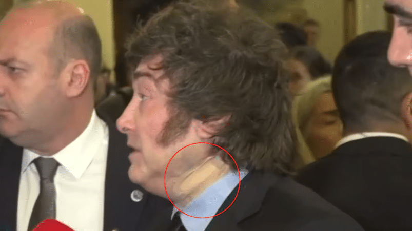 El Gobierno explicó por qué Milei usó una venda durante su viaje a España El Gobierno explicó por qué Milei usó una venda durante su viaje a España